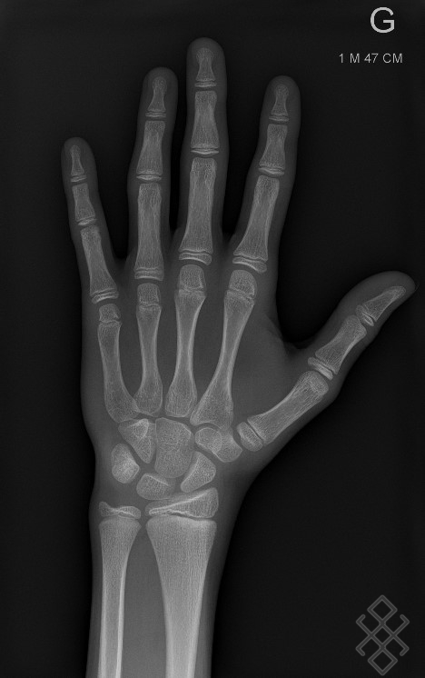 radiographie-ge-osseux-d-finition-d-roulement-prise-de-rdv-en-ligne