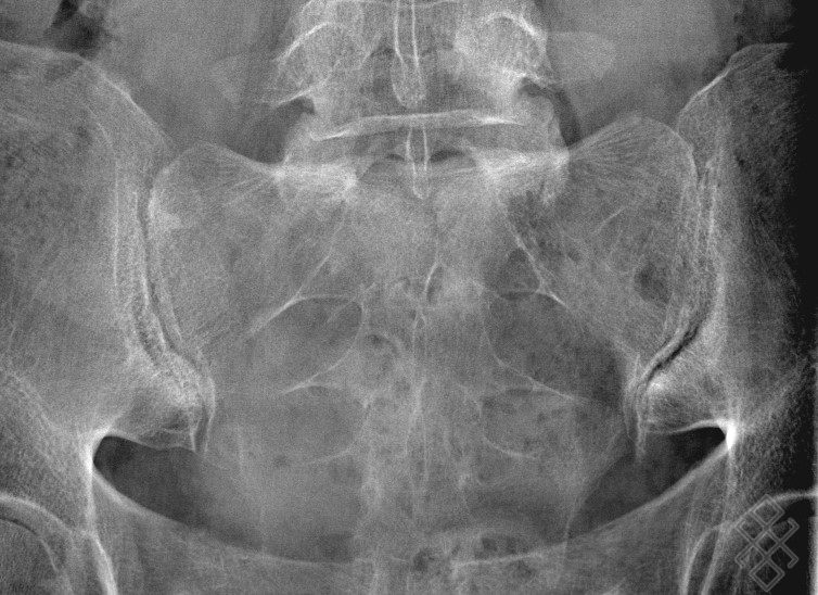 Radiographie des Sacroiliaques Définition & Déroulement Prise de rdv en ligne