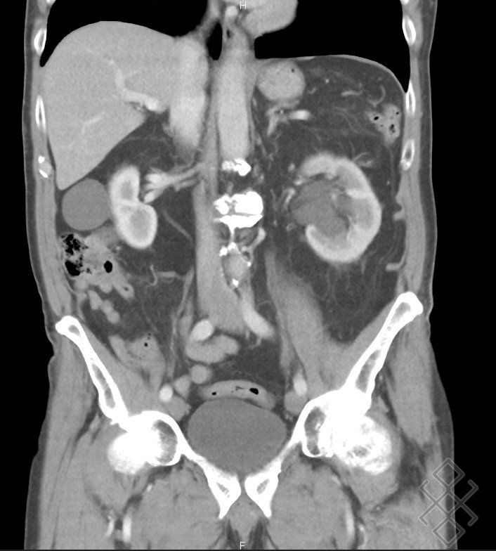 Scanner Abdominal Définition & Déroulement Prise de rdv en ligne