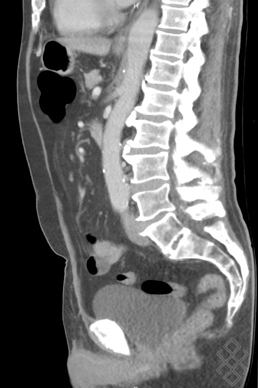 Scanner Abdominal Définition & Déroulement Prise de rdv en ligne