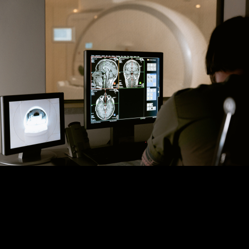 Déroulement MRI